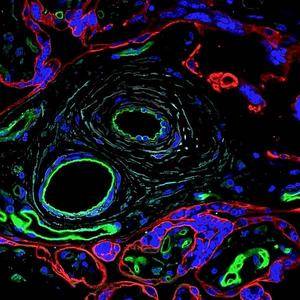 Imagerie confocale à fluorescence de la vascularisation fœto-placentaire au premier trimestre.
