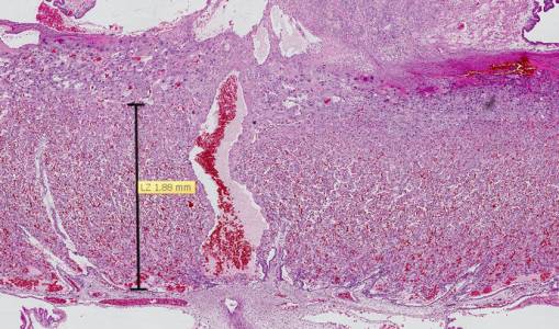 Placenta de rat (Sprague Dawley) au 21ème jour de gestation, coloré à HE (l'hématoxyline et l’éosine). La zone mesurée est le labyrinthe où se trouve le réseau capillaire placentaire.