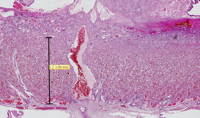 Placenta de rat (Sprague Dawley) au 21ème jour de gestation, coloré à HE (l'hématoxyline et l’éosine). La zone mesurée est le labyrinthe où se trouve le réseau capillaire placentaire.